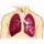 fibrosis pulmonar